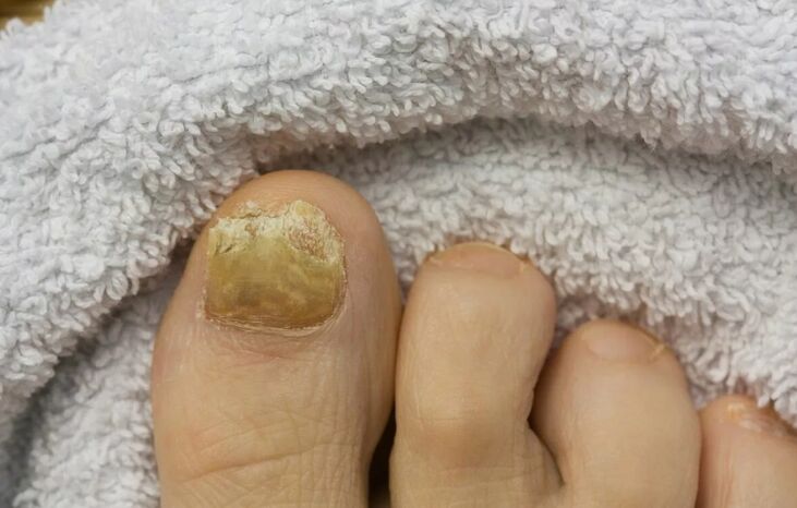 Nails